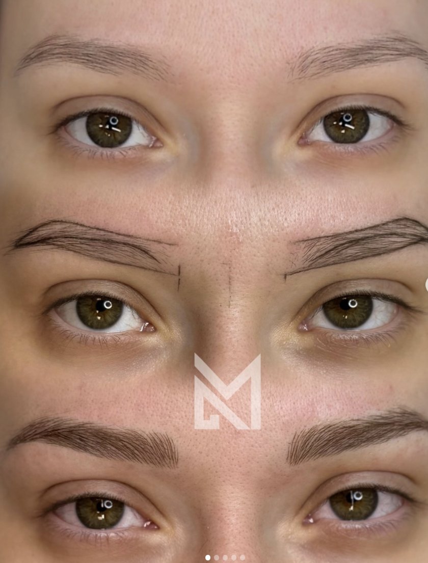 Secuencia antes, boceto y después de micropigmentación de cejas